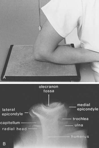 Diagnostic Imaging Of The Elbow Clinical Gate