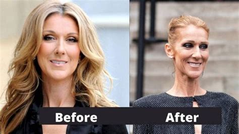 Celine Dion Weight Loss And Health Secret Revealed