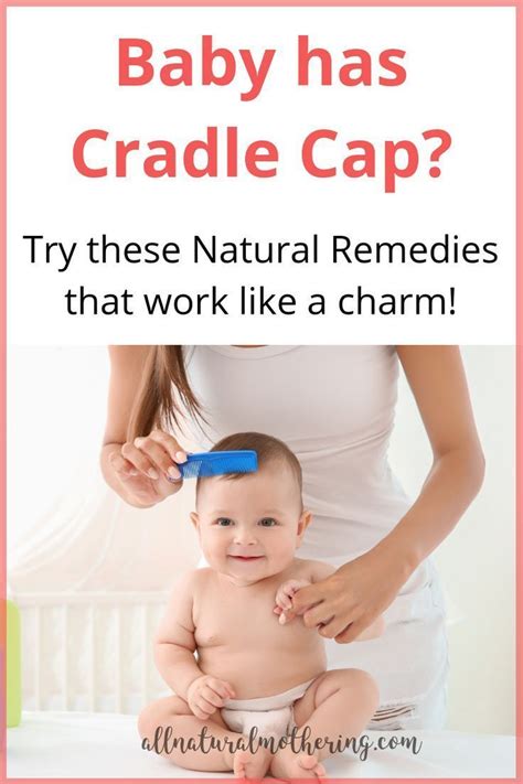 Natural Cradle Cap Remedies That Work Like A Charm Cradle Cap Baby