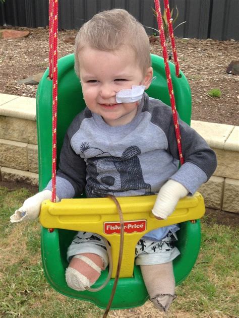 brave riley wins his fight with meningococcal as w strain resurgence strikes in australia