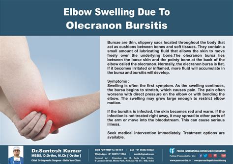 Elbow Swelling Due To Olecranon Bursitis Know It Check If You Have