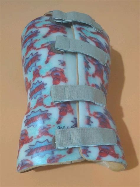 Orthopedic Scoliosis Brace At Rs 9500 आर्थोपेडिक ब्रेसेस In New Delhi