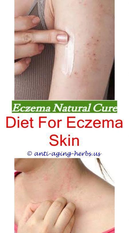 Can You Get Eczema As You Get Older