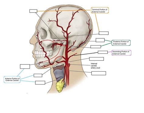 Abstract—carotid artery stenting is a common method of stroke prevention. Branches of the External carotid