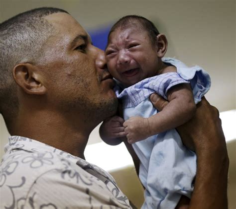 Zika Microcephaly Can Be Developed After Birth Study Says