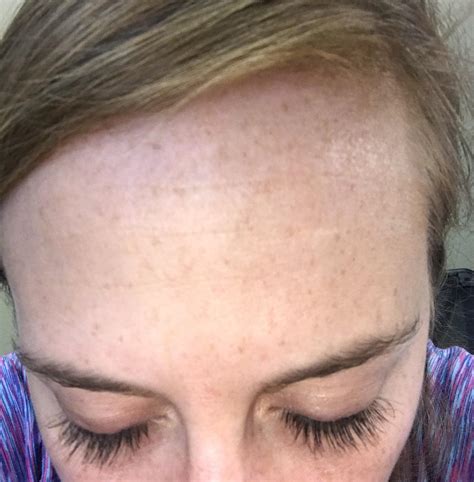 Anti Aging Routine Help Fine Lines On Forehead In Late 20s R