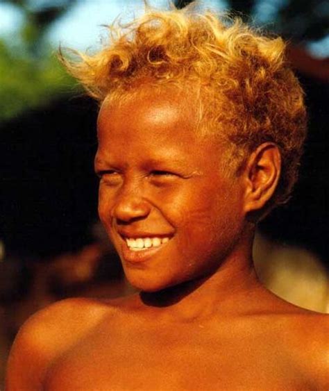 Top Images Blond Hair Gene Minor Genetic Quirk Causes Melanesian