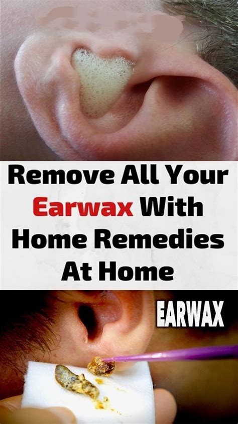 Remove All Your Earwax With Home Remedies At Home Clean Ear Wax Out