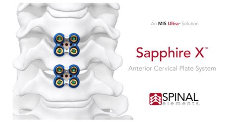 Spinal Elements® Announces 100th Case With Sapphire X™ Anterior