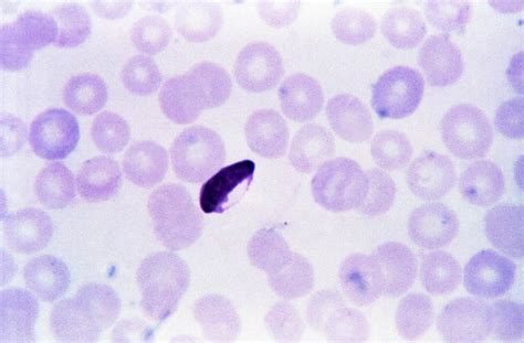 Free Picture Micrograph Plasmodium Falciparum Microgametocyte