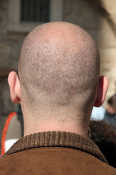 Bald Head Back Pictures Images And Stock Photos Istock