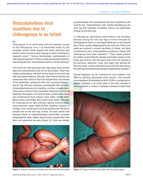 Pdf Vesiculobullous Viral Exanthem Due To Chikungunya In An Infant