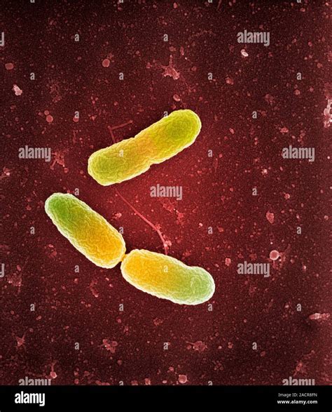 La Bacteria Pseudomonas Aeruginosa Color Micrografía Análisis De