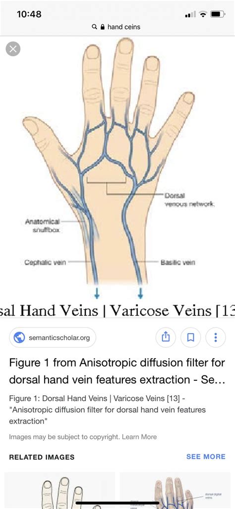 Dorsal Hand Veins