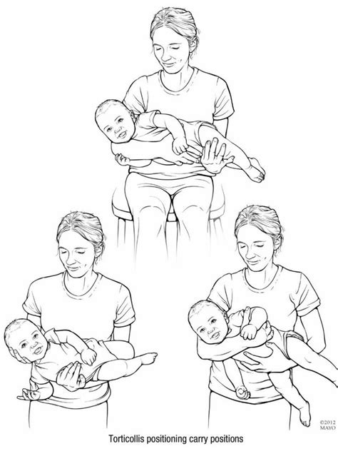 Torticollis Right Side Occupational Therapy Kids Pediatric