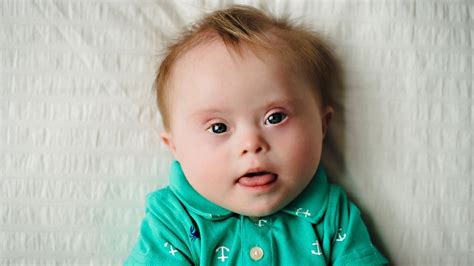 The extra chromosome can affect a person's. Four in five children with Down syndrome are born to ...