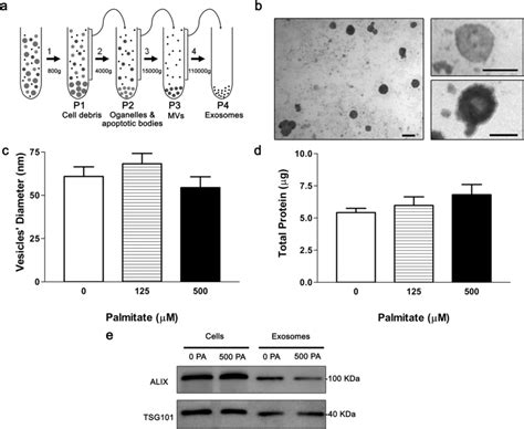 Characterization Of Exosome Like Vesicles Isolated From Conditioned