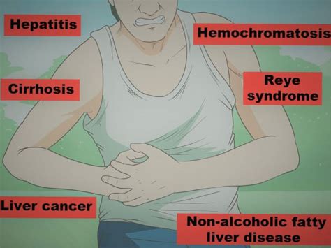 Liver Pain Causes Location Symptoms Diagnosis And Treatment