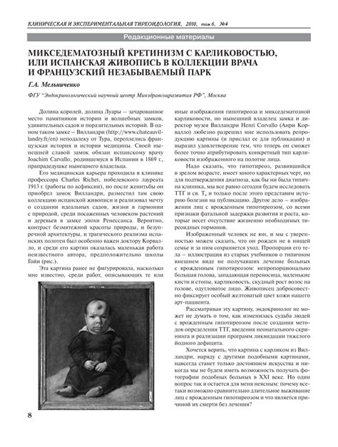 Pdf Myxedematous Cretinism With Dwarfism Or Spanish Painting In
