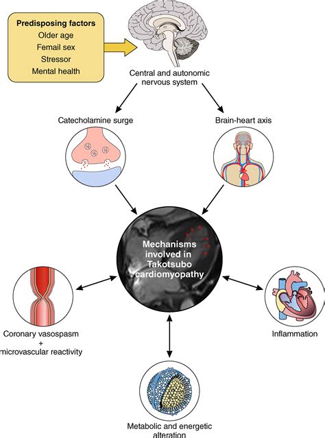 Takotsubo Cardiomyopathy Broken Heart Syndrome Welcome To The World Of Cook Medicine