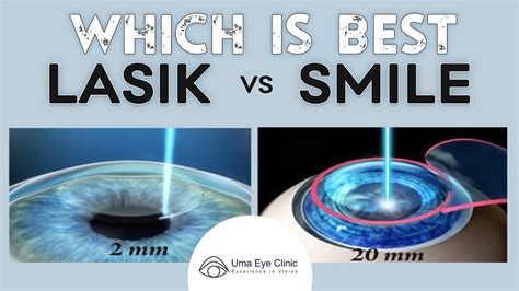Laser Eye Surgery Lasik Vs Smile Dr Arulmozhi Varman Uma Eye
