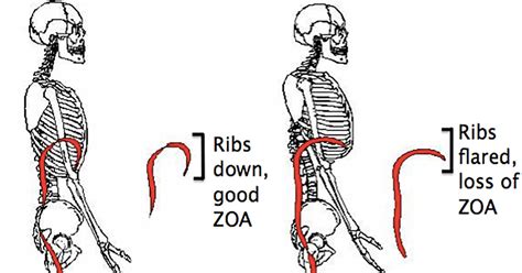 This video includes many structures from thorax and discusses the anatomy of ribs as well as anatomy of rib cage in general. 9 Best Exercises To Correct Flared Ribs Without Surgery