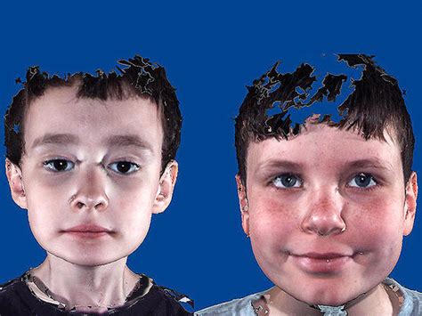 Is It Autism Facial Features That Show Disorder Photo 7 Pictures
