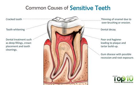 how to get rid of tooth sensitivity fast at home top 10 home remedies