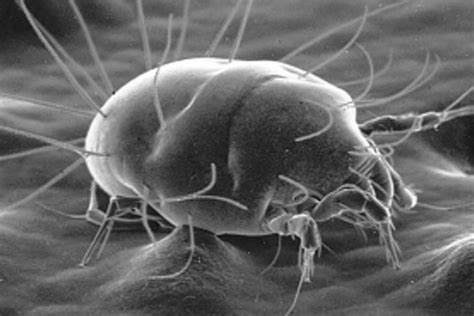 Dust Mites More Harmful To Asthmatics Than Thought News Asiaone