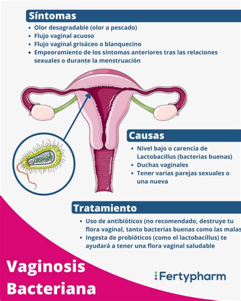 Vaginosis Bacteriana qué es y su tratamiento Fertypharm