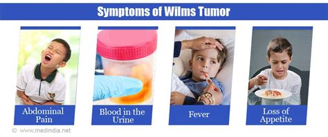 Wilms Tumor Causes Symptoms Diagnosis Treatment And Prevention