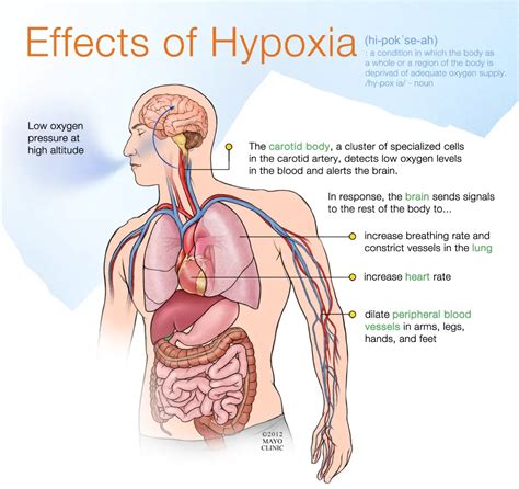 What Are The Signs And Symptoms Of Hypoxia Free Cpr Training