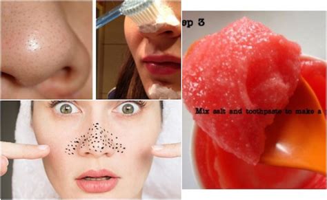 How To Unclog Clean And Shrink Pores On The Nose