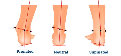 Know Your Arches Uk