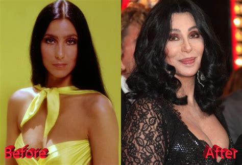Cher Plastic Surgery Just Too Much Of Procedures