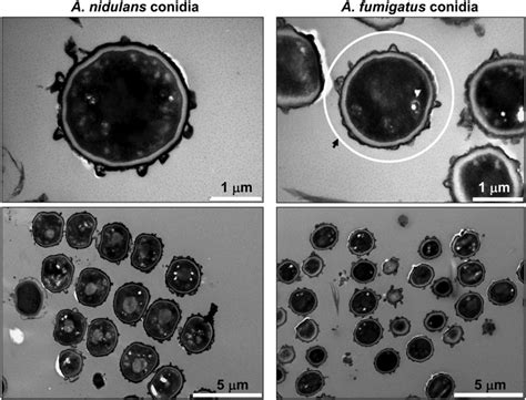 Conidia Of Aspergillus Nidulans And Aspergillus Fumigates Transmission