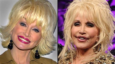 Chatter Busy: Dolly Parton Facelift