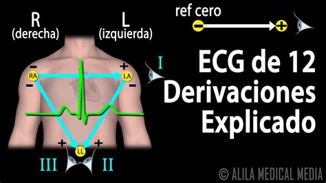 Las 12 Derivaciones Del Electrocardiograma Porn Sex Picture