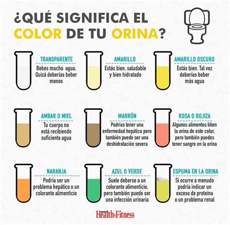 Arriba Foto Color De La Orina Con Hepatitis Actualizar