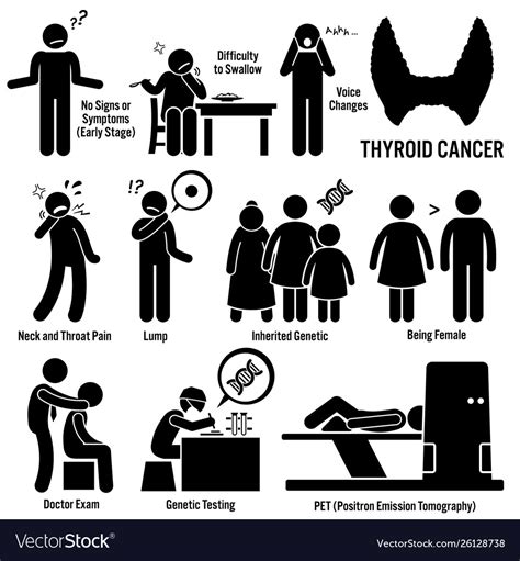 thyroid cancer symptoms causes risk factors vector image