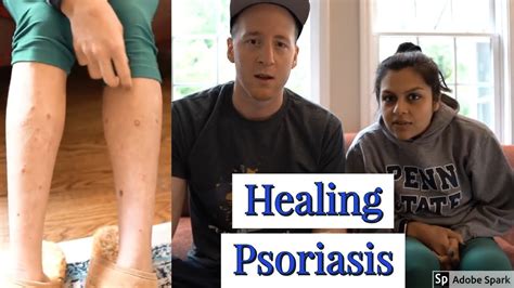 How Megha From Keto Connect Could Heal Her Psoriasisthe Carnivoreketo