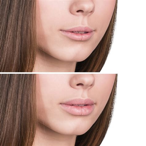 Easiest Way To Get Huge Big Lips Without Surgery Lip Plumper Remedy