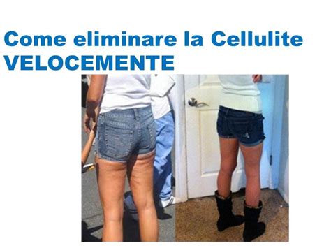 How To Get Rid Of Cellulite Naturally On Thighs Come Eliminare La