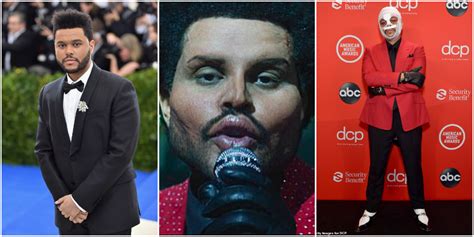 Did The Weeknd Get Plastic Surgery Bol News
