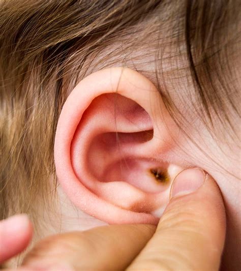 How To Clean Baby Earwax Safety And When To See A Doctor
