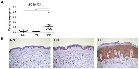 Mcpip1 Expression Is Elevated In Human Psoriasis A Zc3h12a Expression
