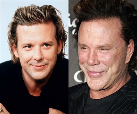 Check out plastic surgery gone wrong with before and after photos of bad celebrity plastic surgeries at womansday.com. Mickey Rourke Plastic Surgery Before and After 2013-2014 Pics