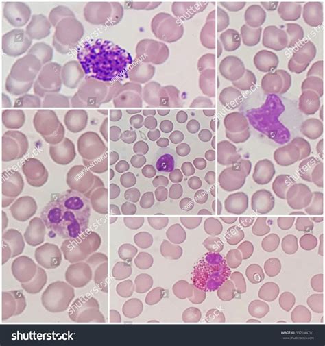 Human Blood Smear White Blood Cells Stockfoto 597144701 Shutterstock