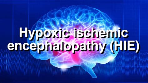 Hypoxic Ischemic Encephalopathy Hie Youtube