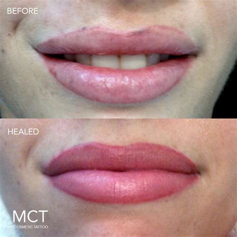Full Lip Tattoo - My Cosmetic Tattoo